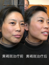 妙醫堂精手法傳承人——王浩丞 妙醫堂精手法傳承人——王浩丞