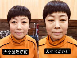 妙醫堂精手法傳承人——王浩丞 妙醫堂精手法傳承人——王浩丞
